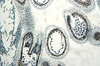 Shepherd's-purse - microscope 