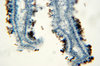 Fungus - microscopic view of s