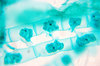 Spirogyra - microscopic view 3