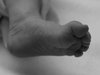 Babyfoot