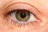 Eye 2
