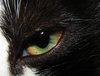 Eye