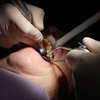 Dental Work