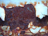 Corrosion 1