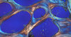 Cancellous Bone 4