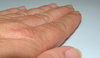 Hand
