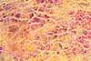 pathway patterns