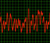 Pulse