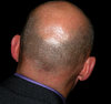 Bald Head