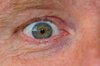 Male eye