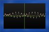 Oscilloscope