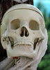 medical model1