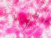 Love 2